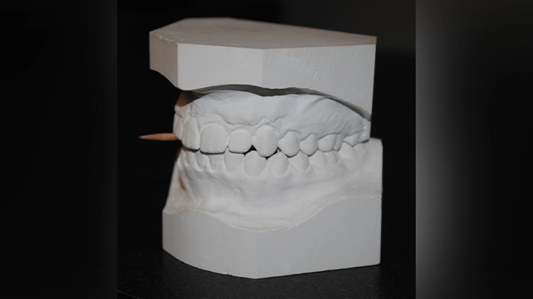 White teeth mold