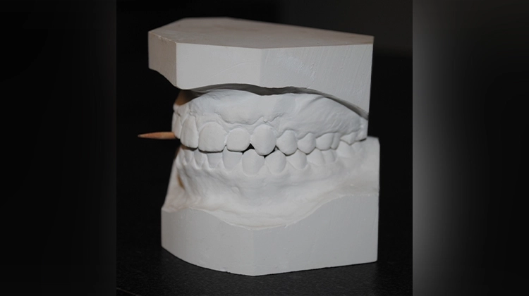 White teeth mold White teeth mold