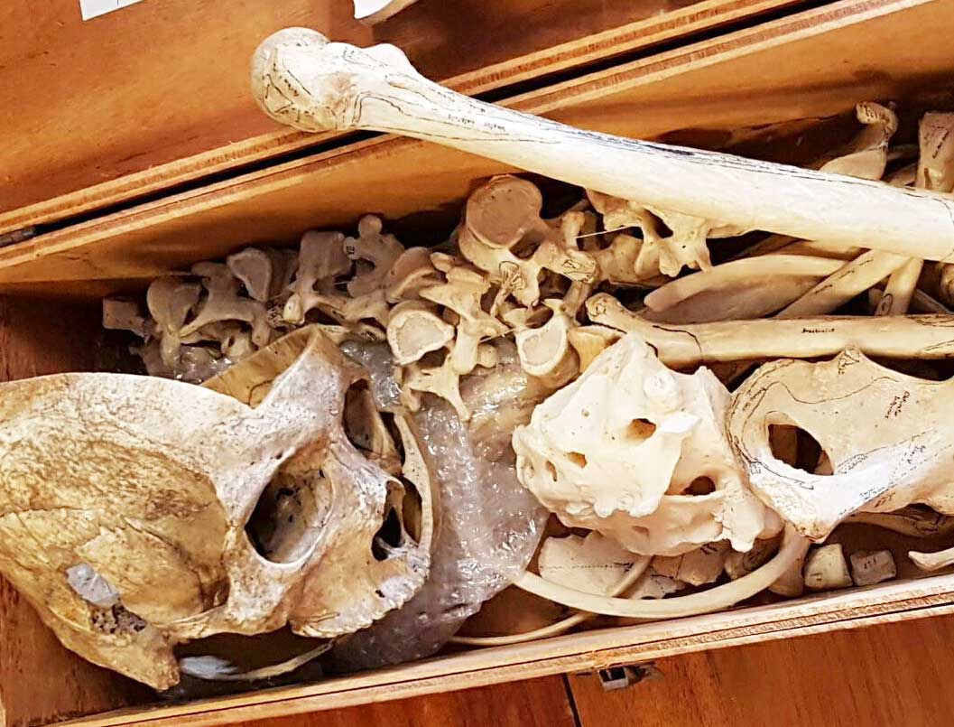 Human remains with a skull and bones